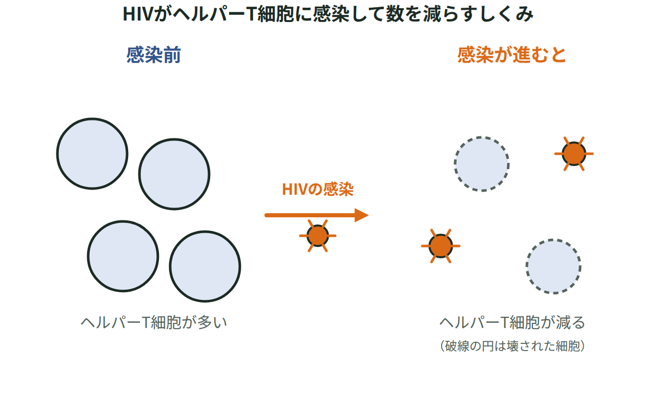 HIVの感染前と感染後でヘルパーT細胞の数が減る様子を2つの状態と矢印で示した図